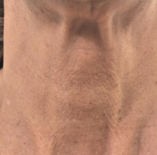 Before/After Image